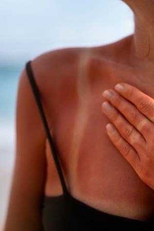 Soin coupe-feu pour apaiser les brûlures et les inflammations énergétiques